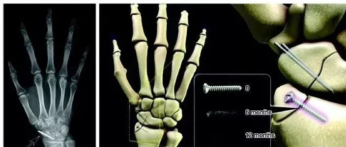 1689576595194660.jpg 4.jpg