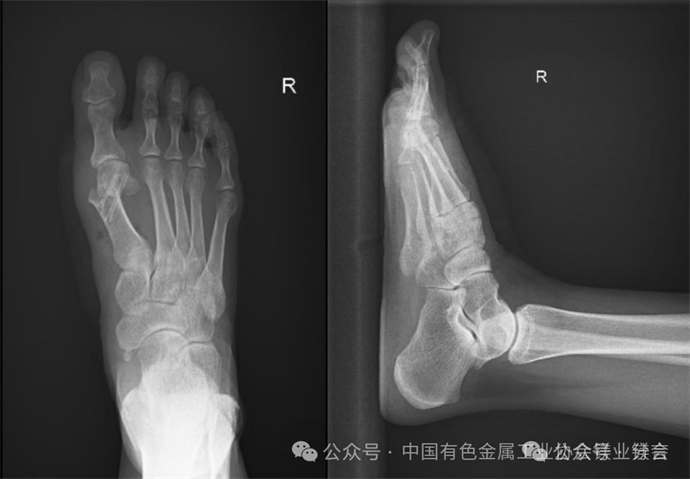 1776072089323603.jpg 1.jpg